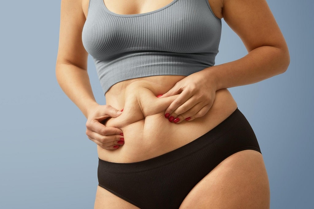 CoolSculpting