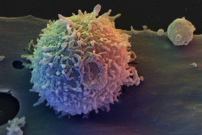 Immune System During COVID-19