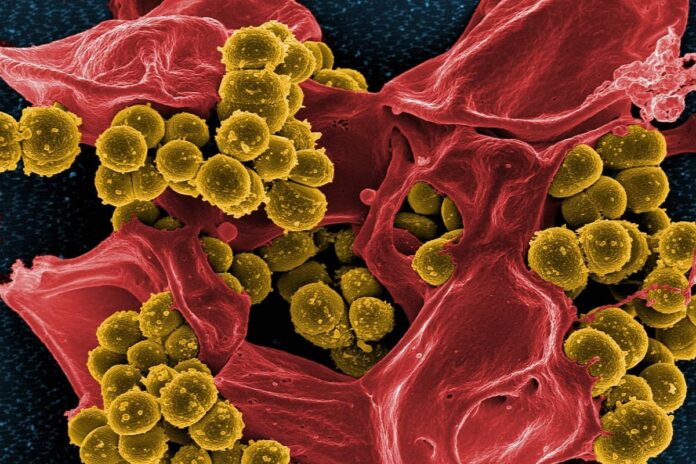 vaginal infections